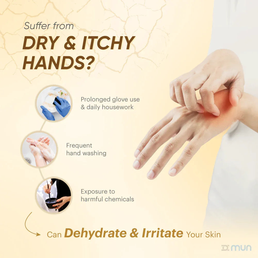 Hand with dry and itchy skin, showing causes and effects on a beige background.