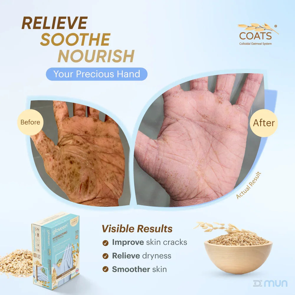 Hand care product advertisement showing before and after effects on skin with Coats brand logo.