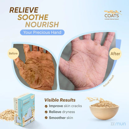 Hand care product advertisement showing before and after effects on skin with Coats brand logo.